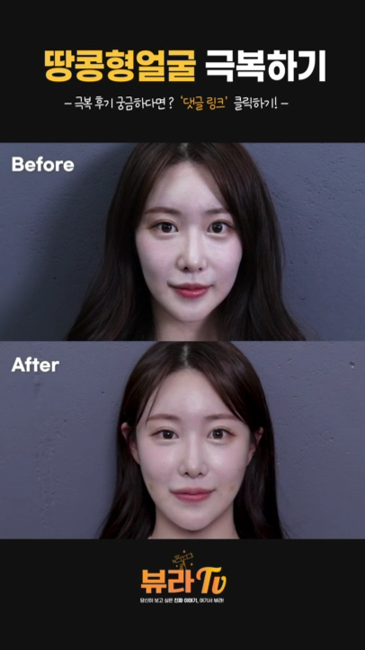 Beauty Lounge Clinic Jamsil