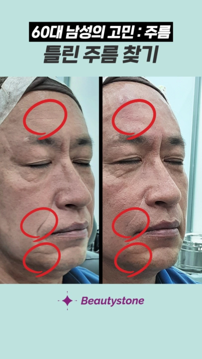 Beauty Stone Clinic Hongdae