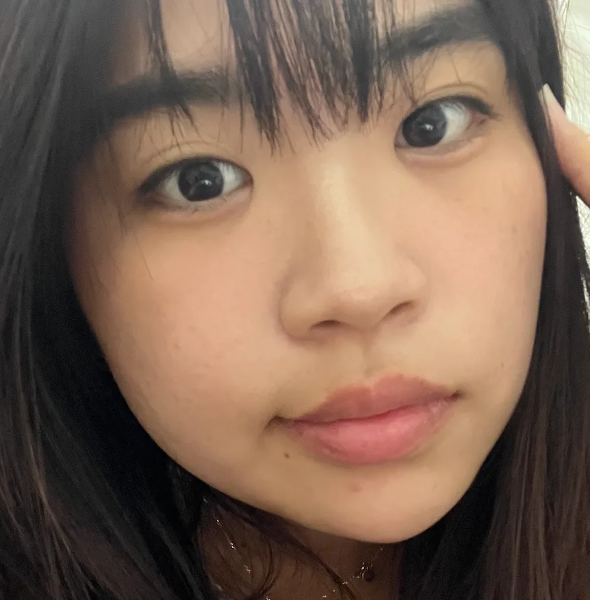 Cheongdam Line Plastic Surgery