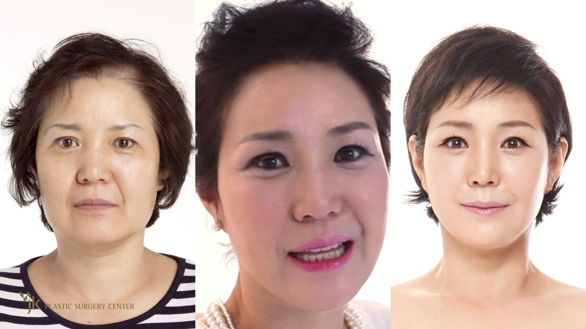 JK Plastic Surgery Center